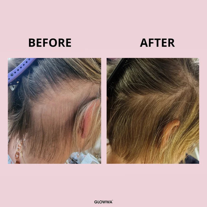 Glowwa Hair Food - Original (Trio)