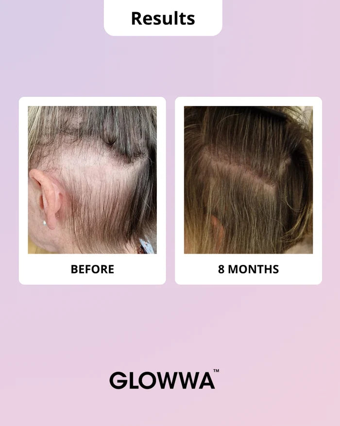 Glowwa Hair Food - Meno (Trio)