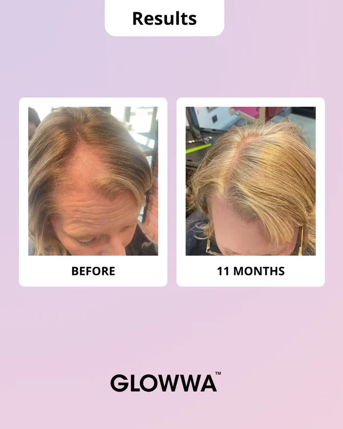 Glowwa Hair Food - Meno (Trio)